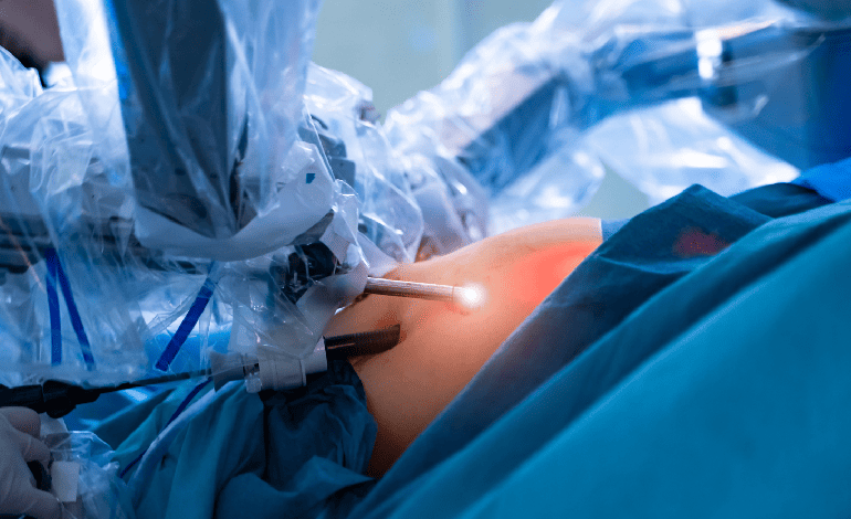 Plastia inguinal laparoscópica tapp